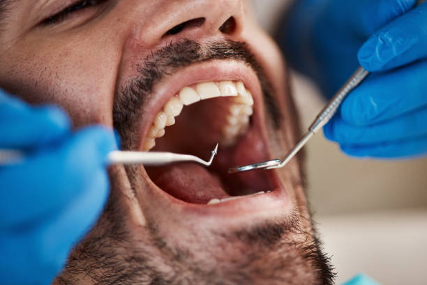 Best Tooth Infection Emergency Dentist  in Desert Aire, WA